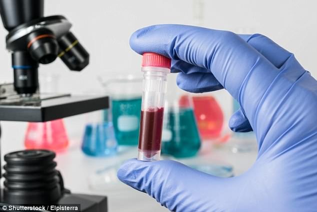 Un nouveau test sanguin peut détecter 10 types de cancer potentiellement plusieurs années avant que quelqu'un ne tombe malade