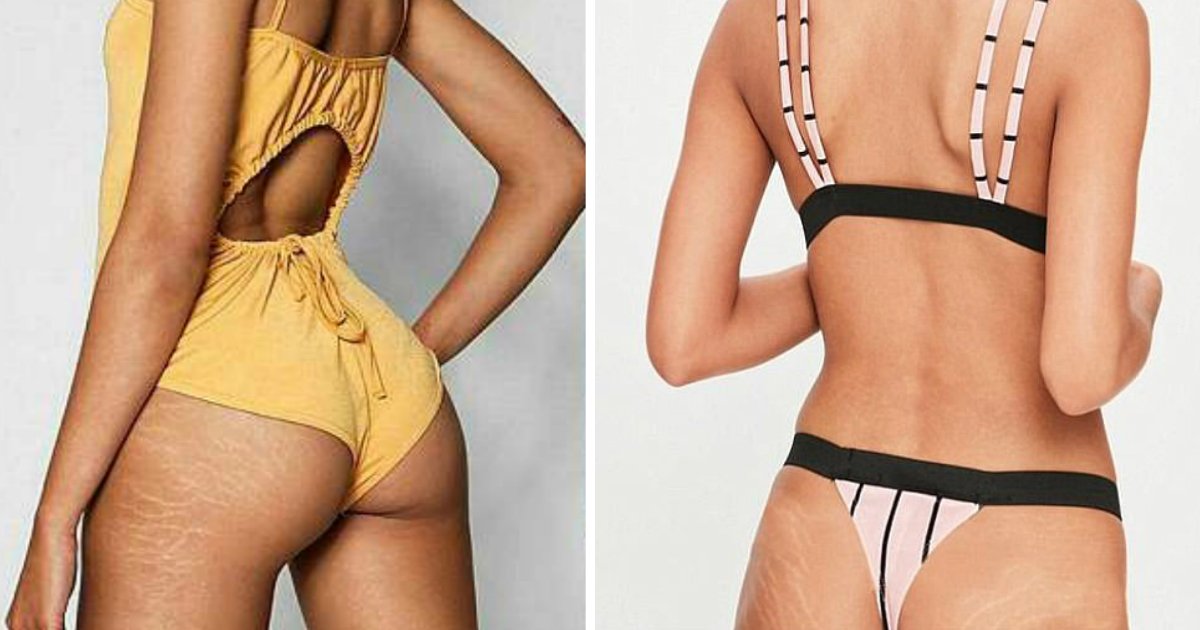 stretch marks.jpg?resize=1200,630 - Picture Of Fashion Model With Visible Stretch Marks Takes Over The Internet, Shoppers Salute The Fashion Site