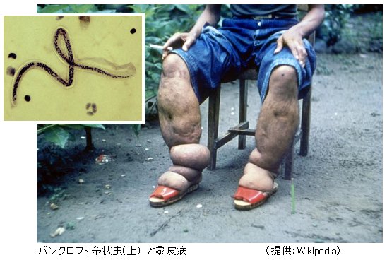 閲覧注意 地球上で最も恐ろしいといわれている寄生虫10選 Hachibachi 閲覧注意 地球上で最も恐ろしいといわれている寄生虫10選 Hachibachi