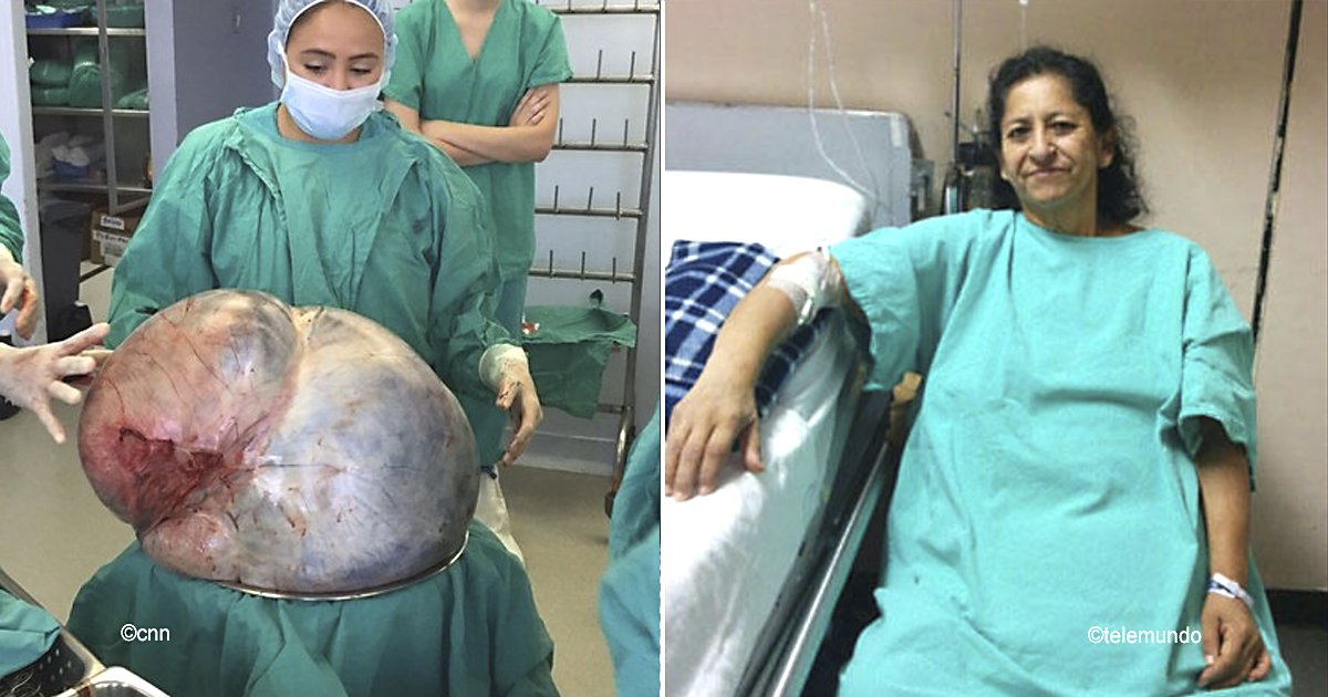 tumor.jpg?resize=1200,630 - Le extrajeron un tumor ovarístico de 60 kilos, la vida de esta mujer de 38 años cambió por completo