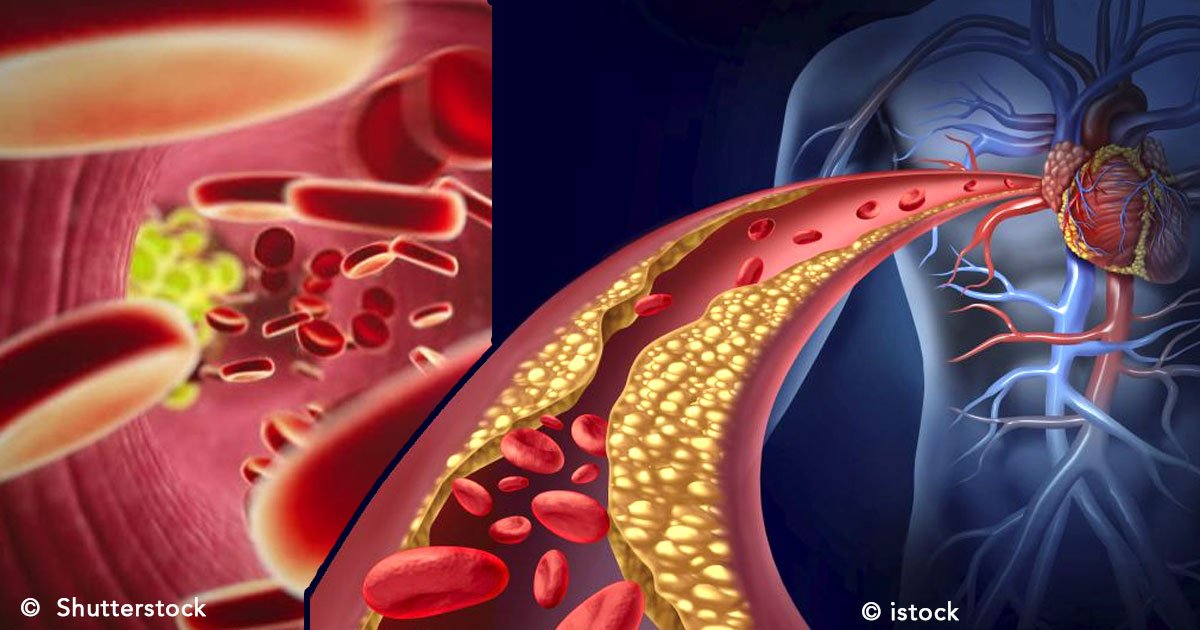 untitled 1 144.jpg?resize=1200,630 - Colesterol alto: síntomas y sus consecuencias