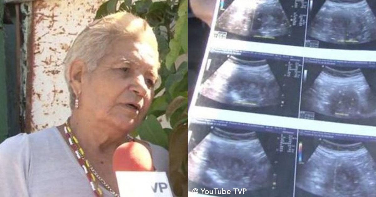untitled 1 33.jpg?resize=1200,630 - Una abuela de 70 años asegura que está embarazada de su octavo hijo, de ser cierto será la madre más longeva del mundo.