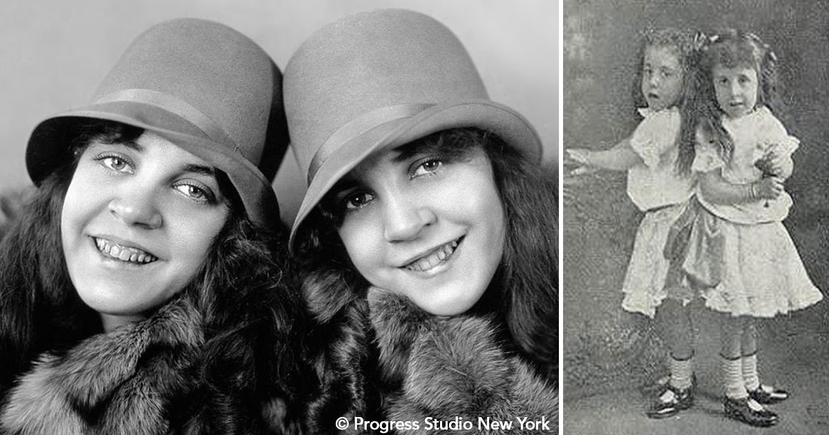 untitled 1 35.jpg?resize=412,232 - La trágica e impactante vida de las famosas gemelas siamesas Violet y Daisy Hilton