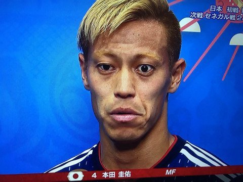 本田圭佑の目がおかしいのはバセドウ病 昔と現在の画像比較あり Hachibachi 本田圭佑の目がおかしいのはバセドウ病 昔と現在の画像比較あり Hachibachi