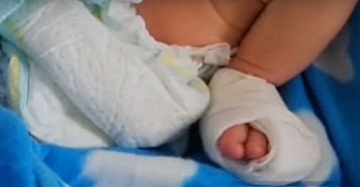 生後二日の赤ちゃんの 足指 を看護師がハサミで切ってしまいました Hachibachi