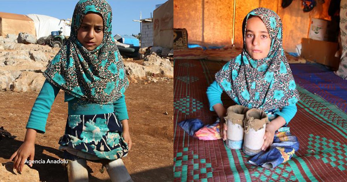 cvo 2.png?resize=1200,630 - Maya, la niña siria que utiliza latas en lugar de prótesis, ahora podrá caminar