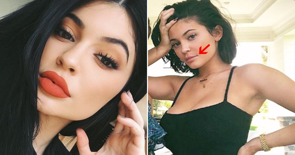 kylie cosmetics side.jpg?resize=1200,630 - Kylie Jenner revela que seu preenchimento labial foi removido e novas imagens confirmam