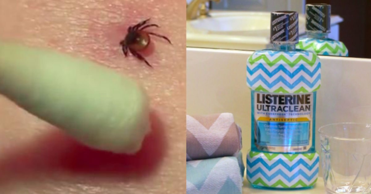 life hacks listerine featured.jpg?resize=1200,630 - Listerine Isn't Just a Mouthwash! Check Out These 15 Amazing Uses for Listerine