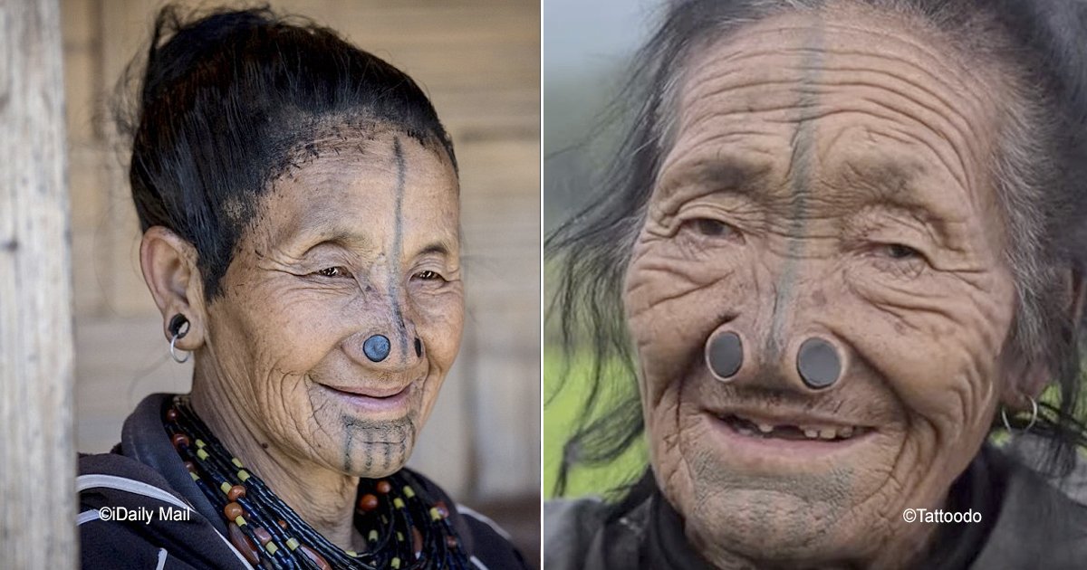 nariz.jpg?resize=1200,630 - Las impresionantes fotografías de las mujeres que se deformaban el rostro para evitar un cruel destino