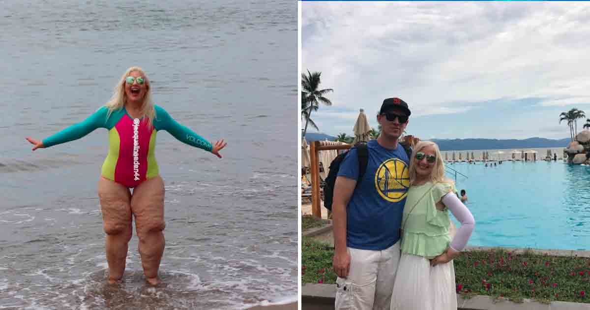 tataaa 3.jpg?resize=1200,630 - Woman Responded To Couple Who Mocked Her Legs After She Lost 300 Pounds