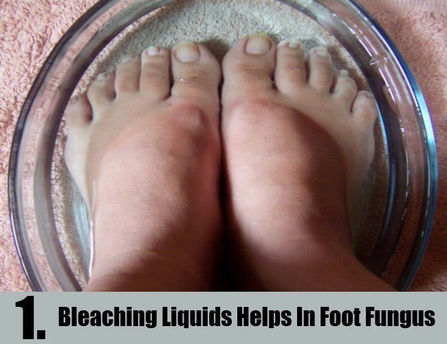 bleaching-liquids-helps-in-foot-fungus