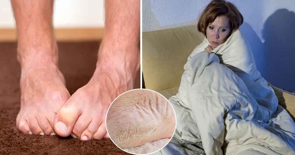 vasg.jpg?fit=1024%2C538&ssl=1&strip=all - Symptoms Of Underlying Health Conditions That Your Feet Might Be Showing