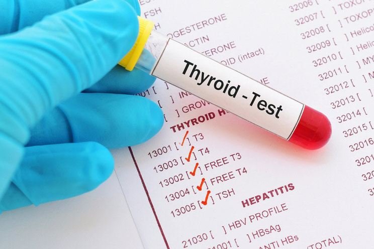 Thyroid-hormone-test.jpg