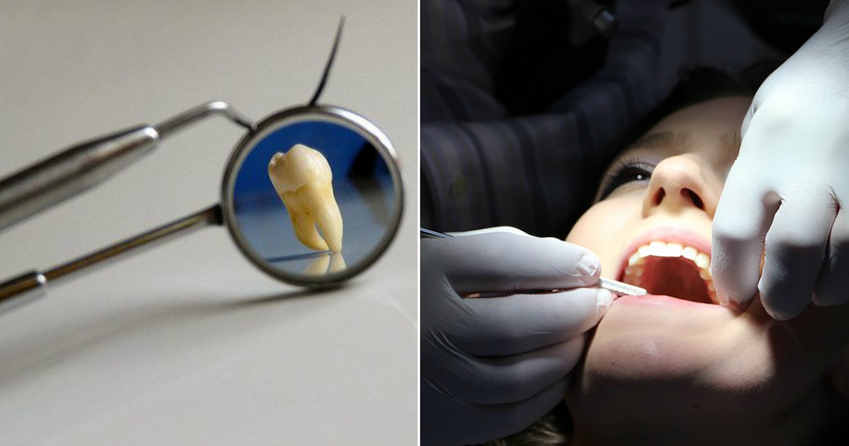 abscessed tooth.jpg?resize=1200,630 - Signes avant-coureurs d'un abcès aux dents que vous ne devriez jamais ignorer