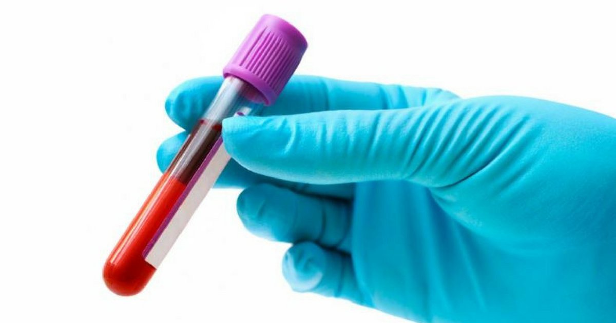 bloodthumb.png?resize=412,232 - Exame de sangue detecta autismo com 88% de precisão