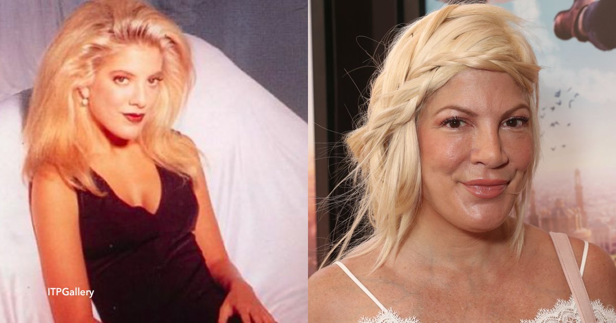 cov 1 18.png?resize=412,232 - Tori Spelling, irreconhecível: A atriz de "Barrados no Baile" é considerada "viciada em botox"