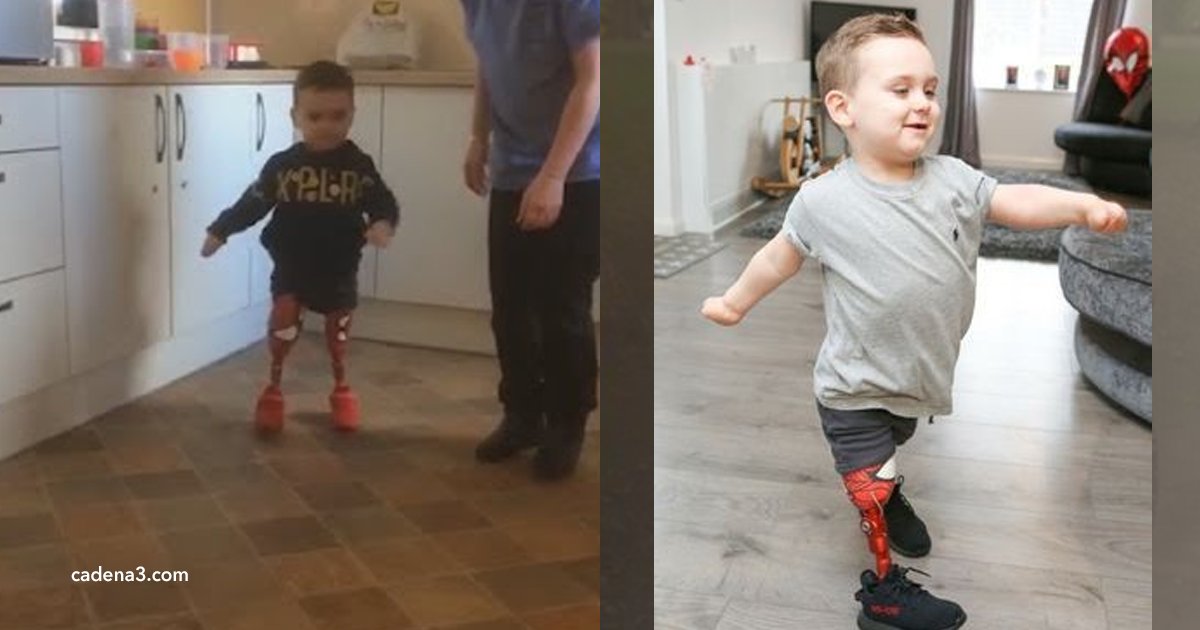 cov 1 4.png?resize=1200,630 - Este menino voltou a andar graças à sua prótese de "Homem Aranha"
