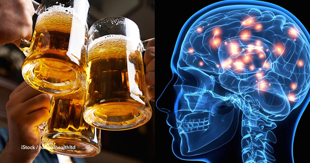 cov 1 49.png?resize=1200,630 - Cientistas aconselham tomar três litros de cerveja ou vinho por semana para proteger o cérebro