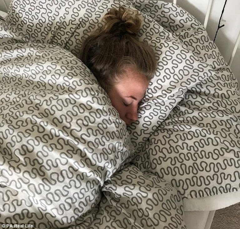 18 Year Old Girl With Rare ‘sleeping Beauty Syndrome Revealed How Alcohol Triggers Deep