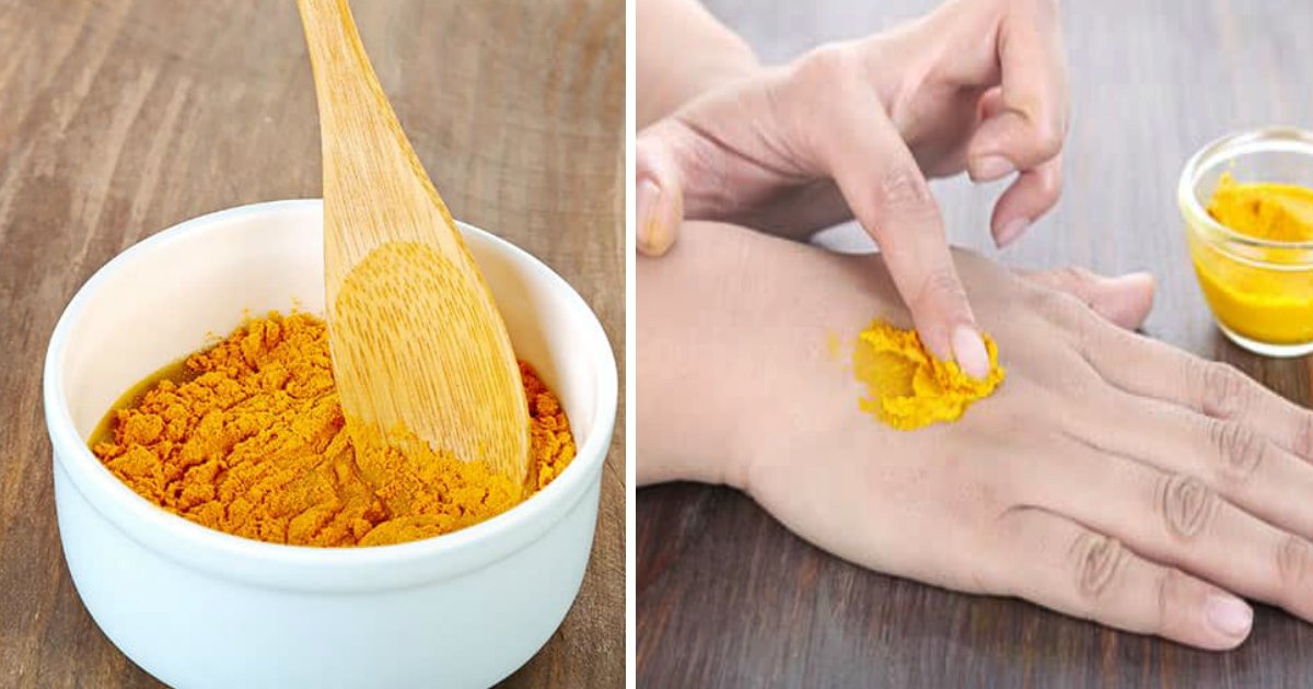 home remedies.jpg?resize=412,232 - 7 Home Remedies for Skin Fungus That Actually Work