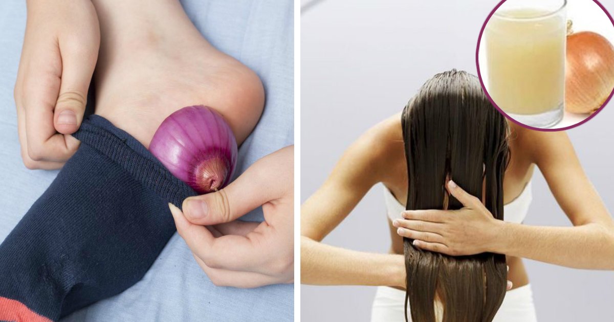 onion.jpg?resize=412,275 - Incredible Uses For Onions That You'd Never Expect