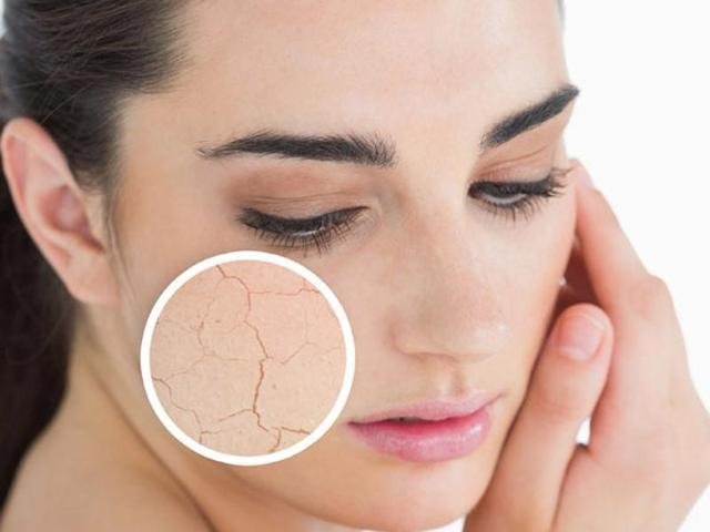 Dry and irritated skin Dry and irritated skin
