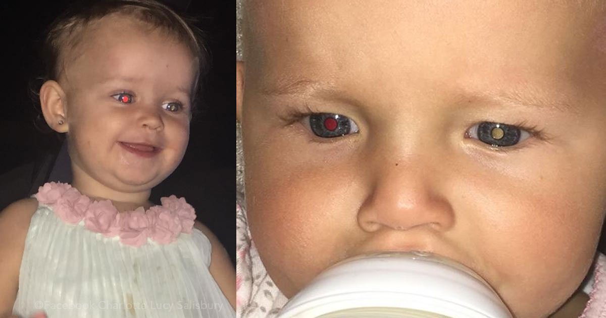 untitled 1 67.jpg?resize=1200,630 - Compartió una foto de su bebé cuando tuvo un extraño cáncer de ojo y salvó la vida de otro pequeño