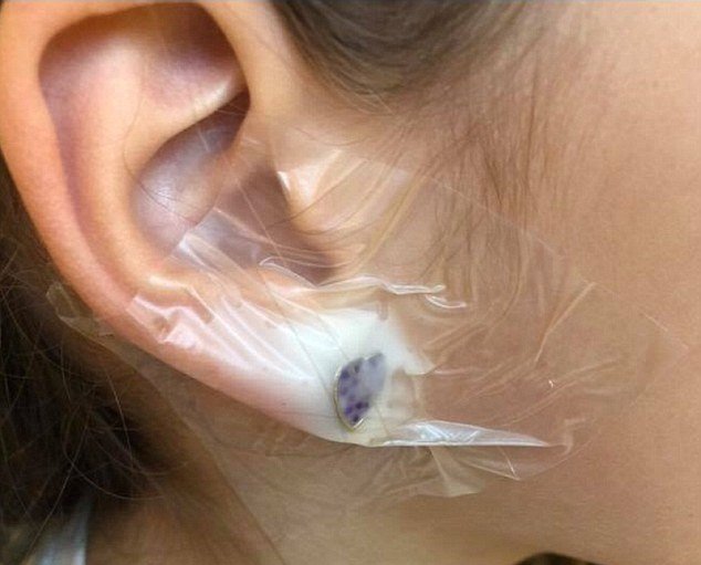 Une Petite Fille Est Hospitalisee Apres Avoir Fait Percer Ses Oreilles Chez Claire S Vonjour Une Petite Fille Est Hospitalisee Apres Avoir Fait Percer Ses Oreilles Chez Claire S Vonjour