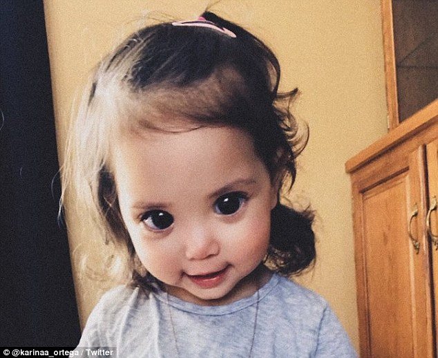 Mehlani Martinez, nearly two, has Axenfeld-Gieger syndrome, a rare genetic disorder that causes under-developed or missing irises. Her giant eyes are nearly all pupil, making her look like a Disney princessÂ 