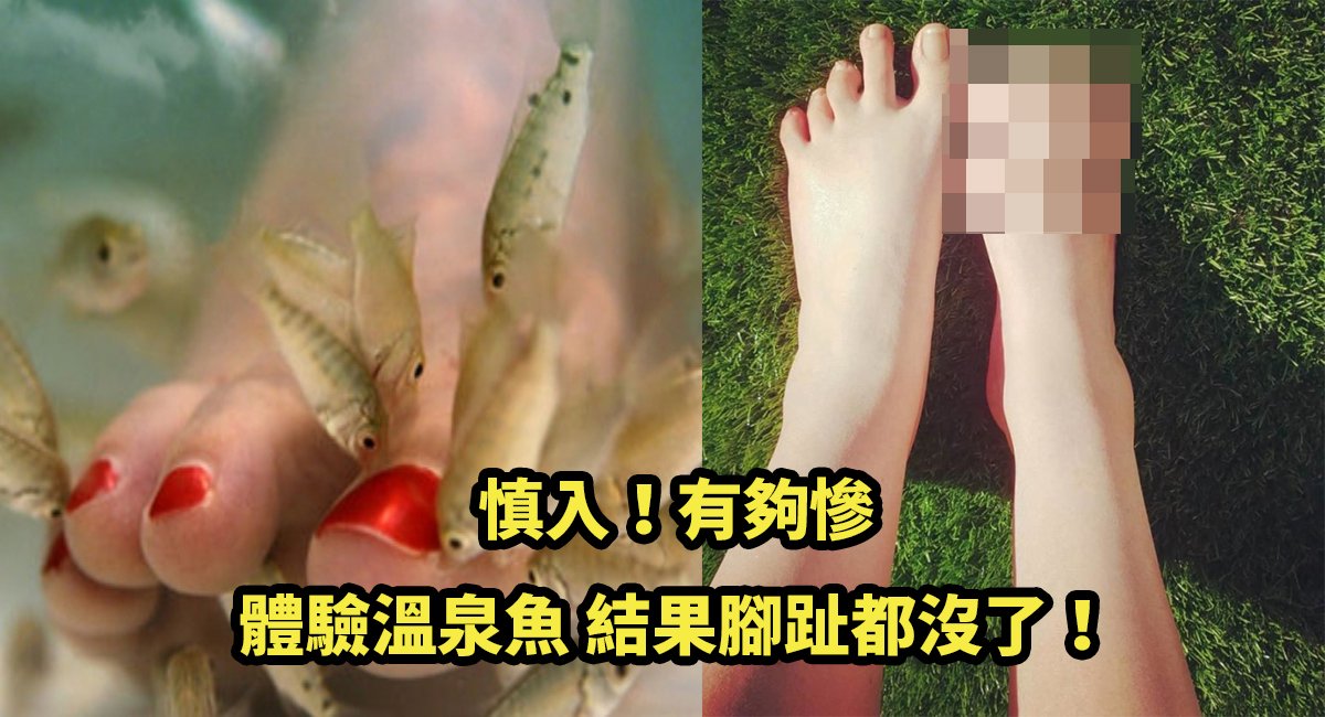 e6baabe6b389e9ad9ae5aeb3e688aae882a2.jpg?fit=1024%2C555&ssl=1&strip=all - 澳洲女子到泰國體驗溫泉魚療，結果一連串的悲劇接連發生，最後她的右腳腳趾全沒了！