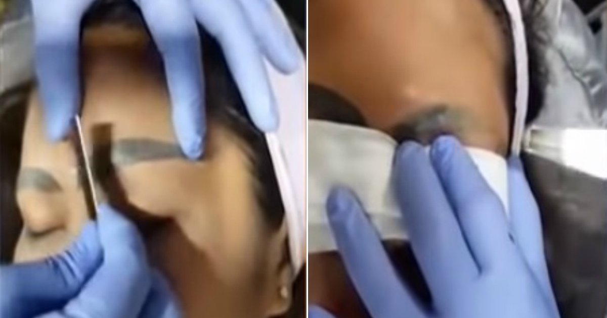 eyebrow tattoo.jpg?resize=1200,630 - Une femme avec des sourcils mal tatoués subit une intervention pour les faire retirer