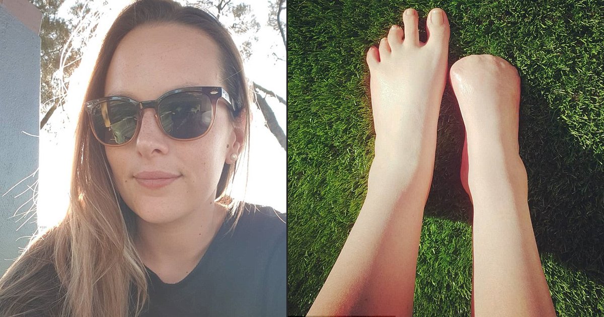 gagag.jpg?resize=1200,630 - Une femme australienne a eu ses cinq orteils amputés après avoir été dans un fish spa thaï