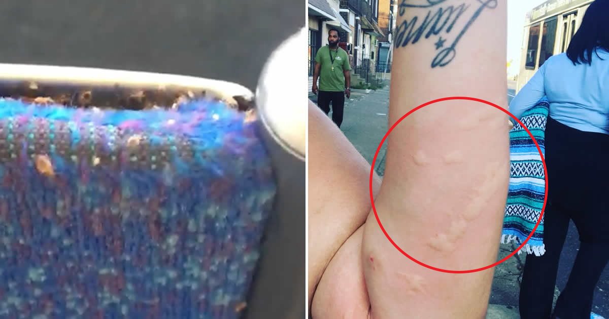 gsgsgs.jpg?resize=1200,630 - Bus Passenger Discovered ‘Thousands Of Bedbugs’ Swarming Her Seat And She Was Left With 'Burning Arm'