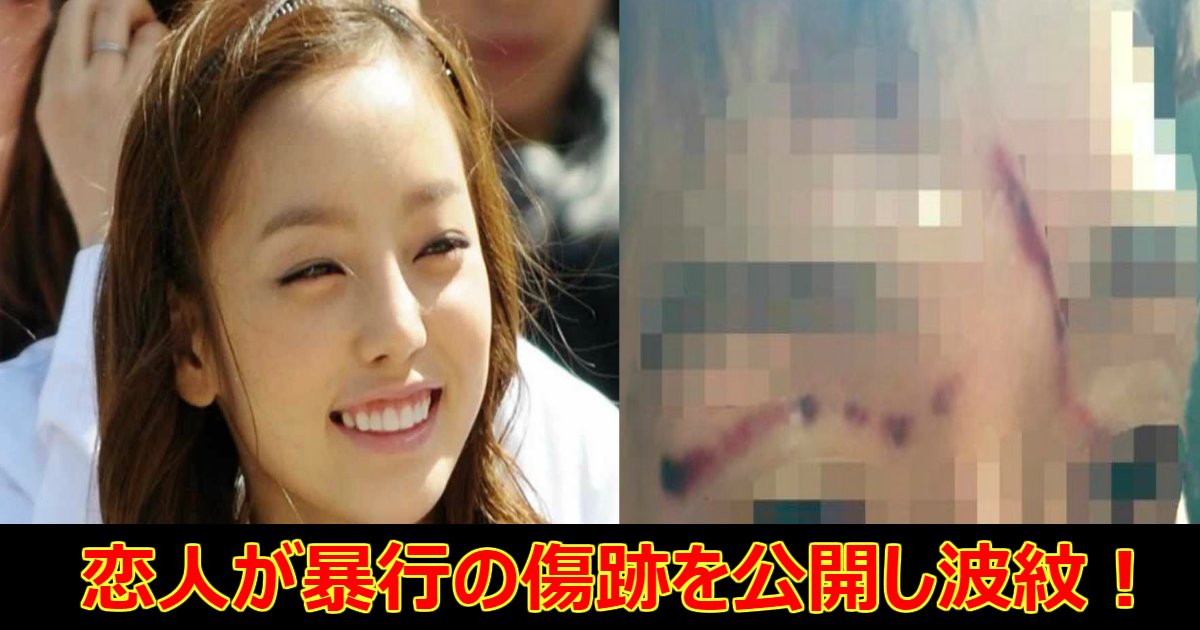 hara.png?resize=1200,630 - KARAハラ、恋人と喧嘩の末に暴行にまで発展し警察沙汰に！