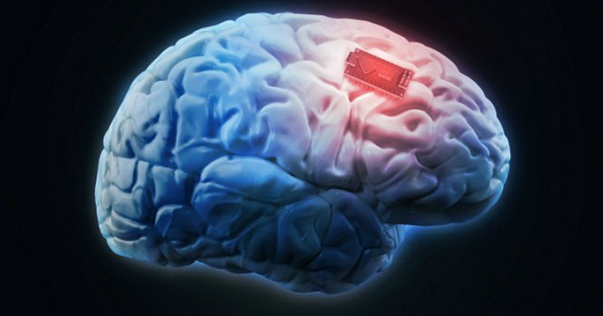 implant.jpg?resize=412,232 - Grande découverte ! Un implant cérébral pourrait arrêter les crises d'épilepsie en libérant un produit chimique naturel