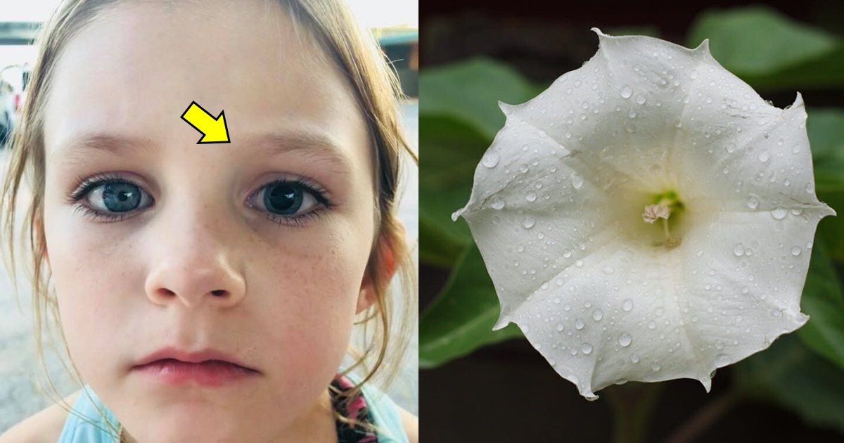 lakdflj.jpg?resize=1200,630 - Madre alerta en Facebook después de que la pupila de su hija se dilatara debido a una flor