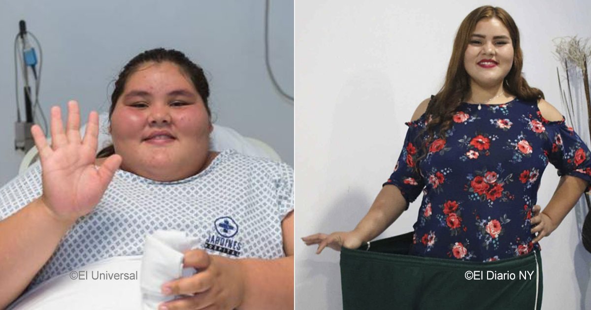 obesidad 2.jpg?resize=412,275 - Tenía sólo 14 años y pesaba 195 kilos, para celebrar sus 15 años bajó a 85, la historia de esta joven conmocionó a México