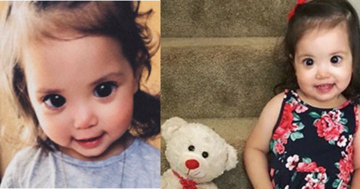 untitled design 1 13.png?resize=412,232 - Mother Revealed Her 2-Year-Old Daughter’s ‘Magical' Eyes are Actually A Rare Eye Disorder