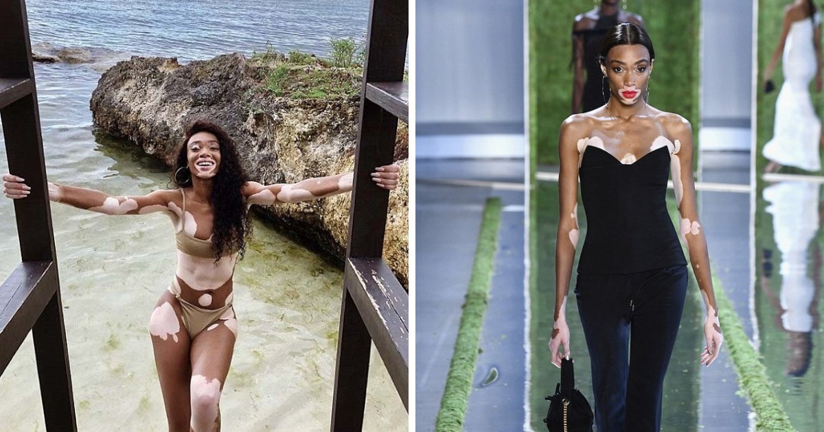 untitled design 36.png?resize=412,275 - Winnie Harlow tem o prazer de ser anunciada como modelo do Victoria's Secret