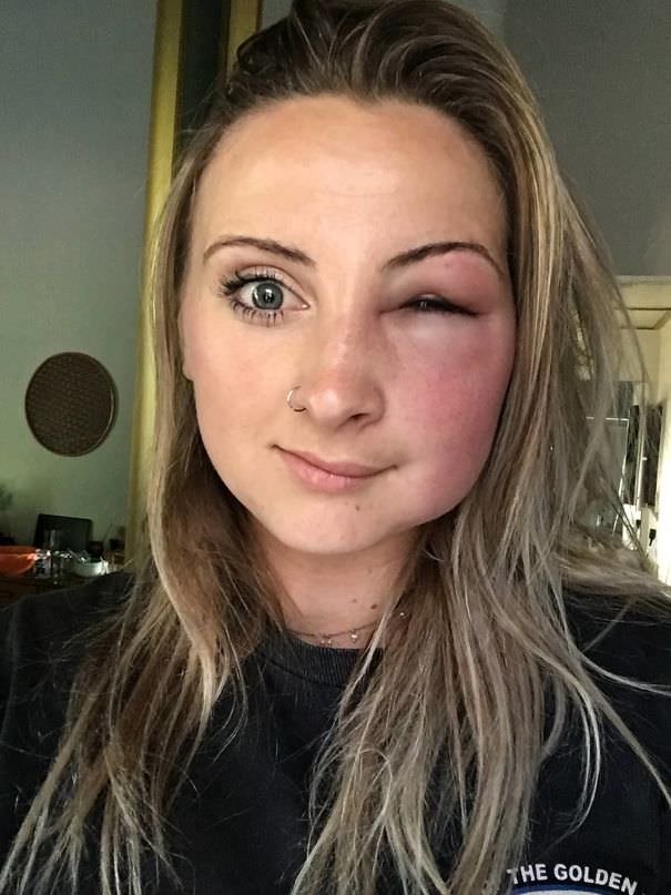 I