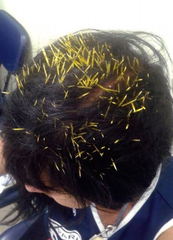 A Porcupine Fell From A Tree And Fell On Her Head. The Apex Of Unluckiness