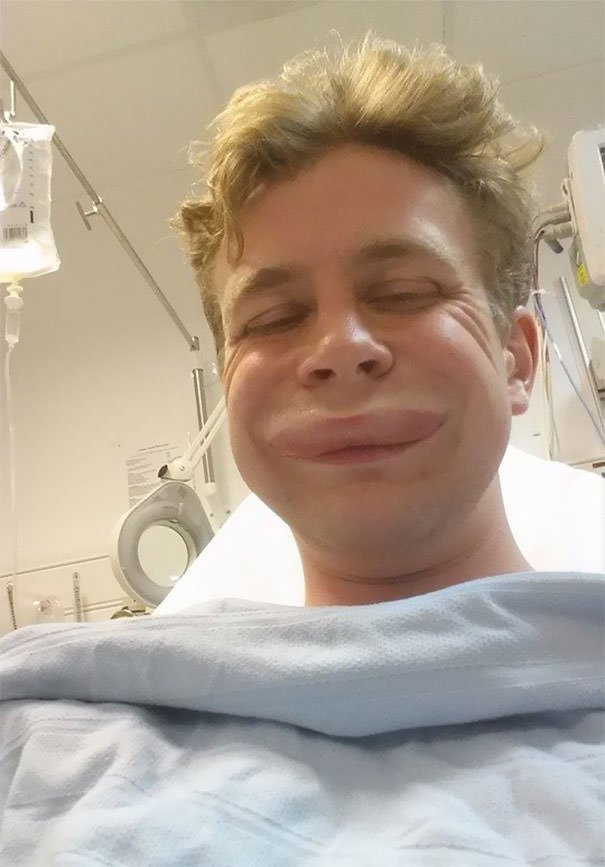 Friend Had An Allergic Reaction And Took A Hospital Selfie