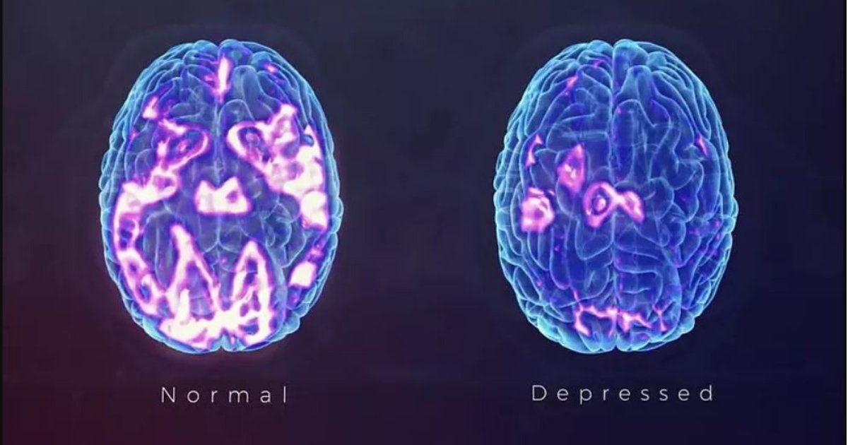 divya1 11.png?resize=1200,630 - Une récente recherche révèle certains faits sur la dépression - ce n'est pas un choix, c'est une sorte de dommage cérébral