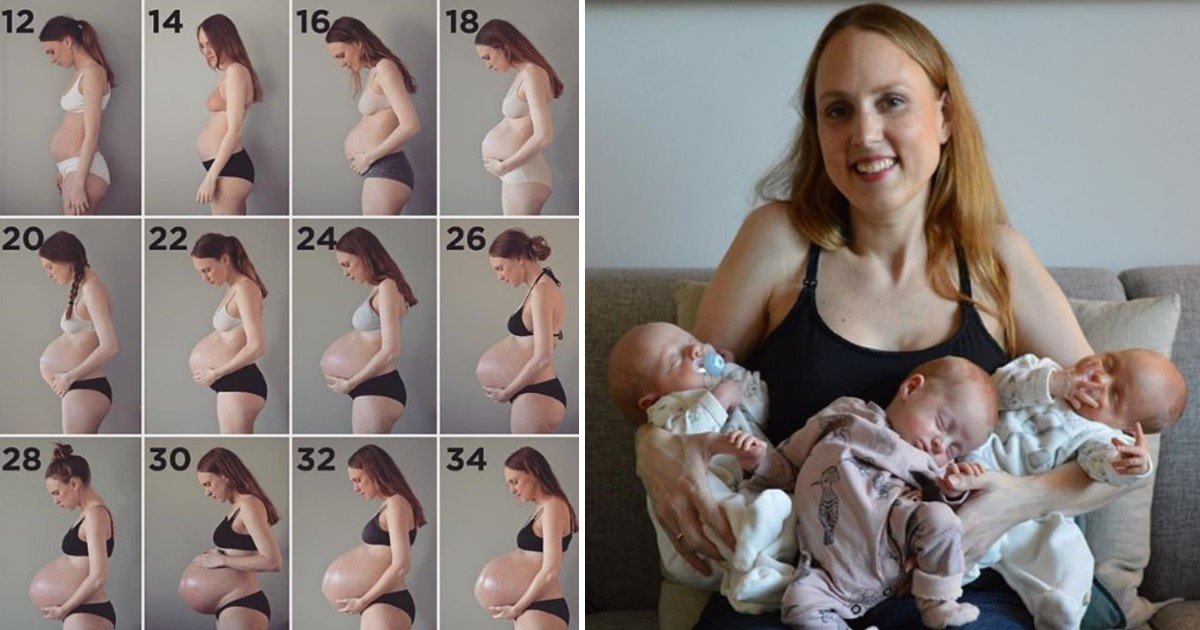 featured image 65.jpg?resize=1200,630 - Mother Of Triplets Who Shared Video Of Her Huge Stomach Is Praised For Showing The 'Reality' Of New Mother's Body