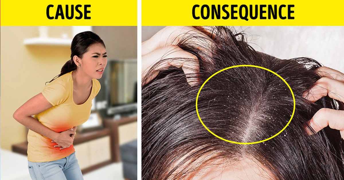 hahaha.jpg?resize=1200,630 - 5 Things Your Hair Is Desperately Trying To Tell About Your Health