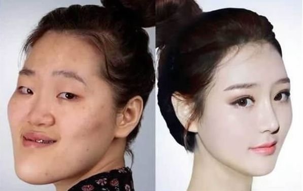 韓国芸能人の整形カミングアウト衝撃ランキング 男女別に紹介いたします Hachibachi 韓国芸能人の整形カミングアウト衝撃ランキング 男女別に紹介いたします Hachibachi