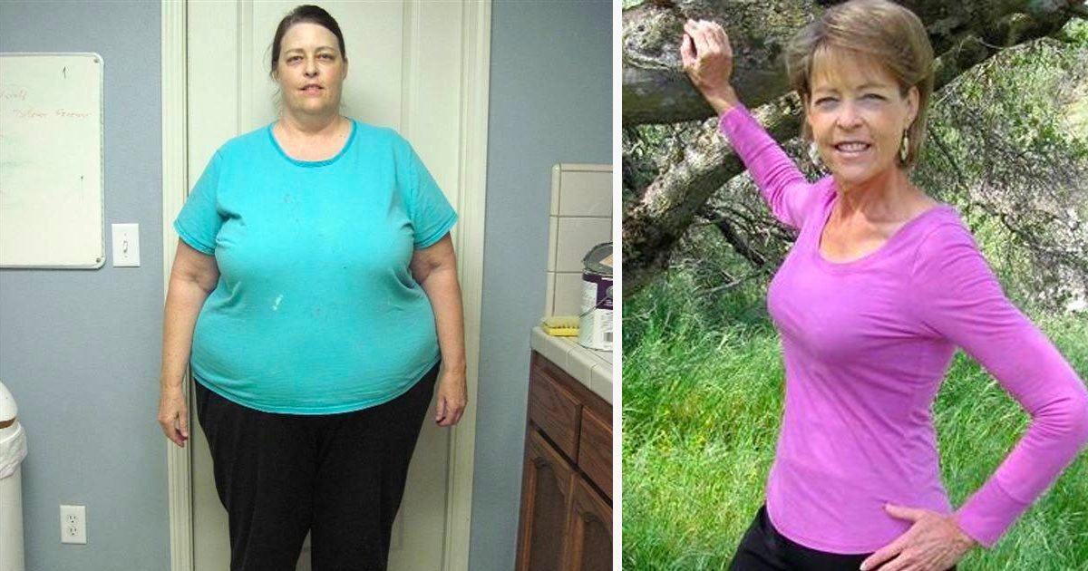 63 Year Old Woman Revealed How She Managed To Lose Half Of Her Weight Small Joys