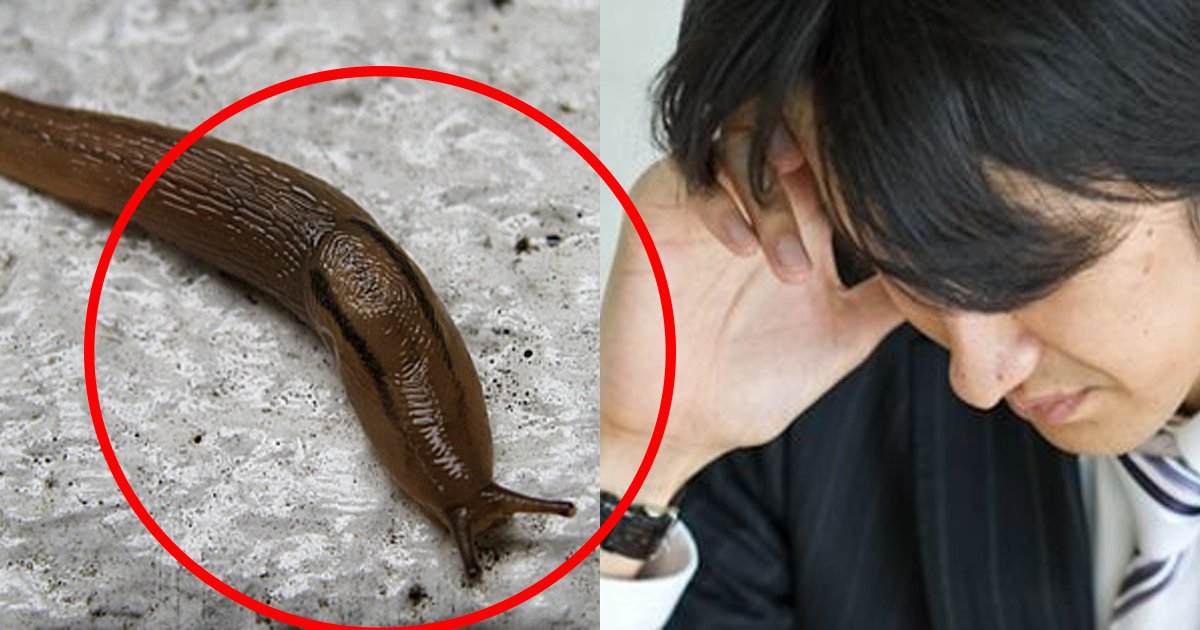 snail.jpg?resize=1200,630 - ふざけてナメクジを食べた男性が、脳を侵す寄生虫に感染...