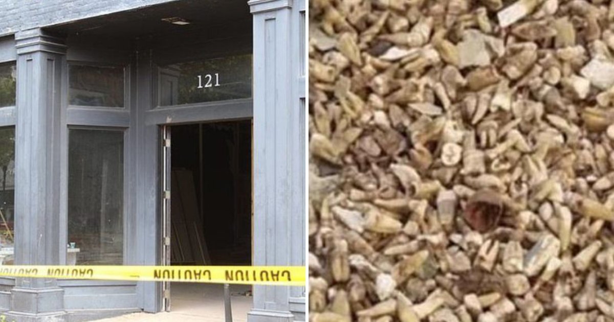 teeth5.png?resize=1200,630 - Des ouvriers du bâtiment ont découvert 1 000 dents humaines cachées dans un mur