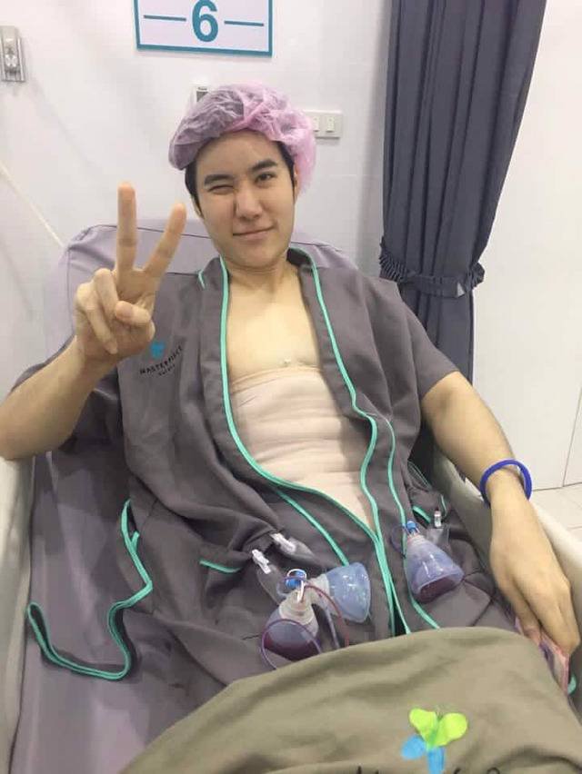 태국 남자 전신 근육 성형.jpg | 인스티즈